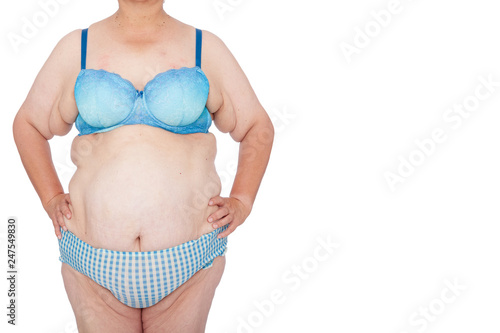 Middle aged woman with excess skin after babies and extreme weight loss. Before brachioplasty, panniculectomy, abdominoplasty and mummy makeover. Full body front view hands on hips, copy space right.