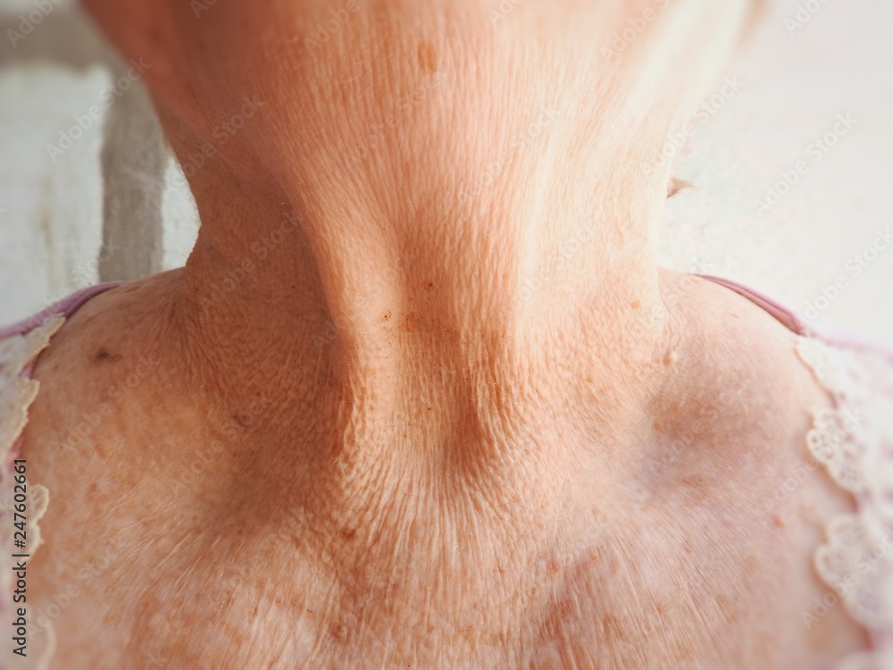 Fototapeta premium Collar and neck with wrinkles of elderly woman wrinkles