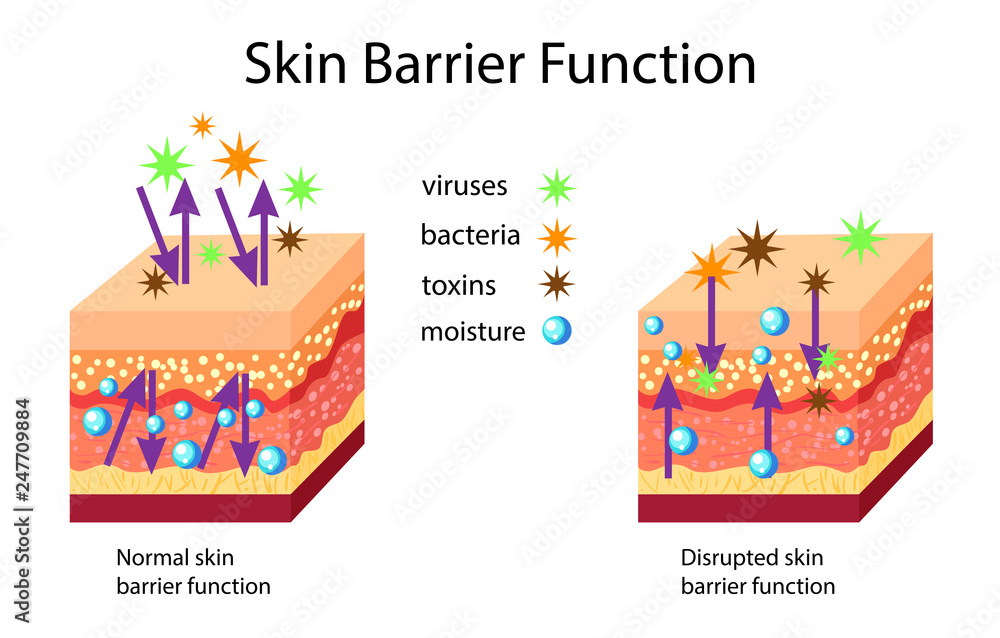 Skin Barrier Function Normal And Disrupted Vector Illustration Stock 