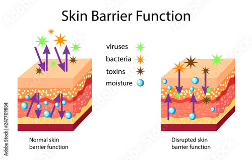 Skin barrier function, normal and disrupted, vector illustration photo