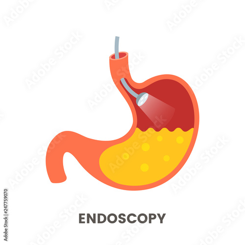 Stomach endoscopy is a flat cartoon endoscope in the stomach through the esophagus. Gastroscopy with light. flat vector illustration isolated on white background