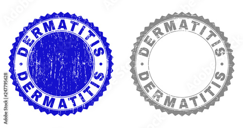 Grunge DERMATITIS stamps isolated on a white background. Rosette seals with grunge texture in blue and gray colors. Vector rubber stamp imitation of DERMATITIS caption inside round rosette.