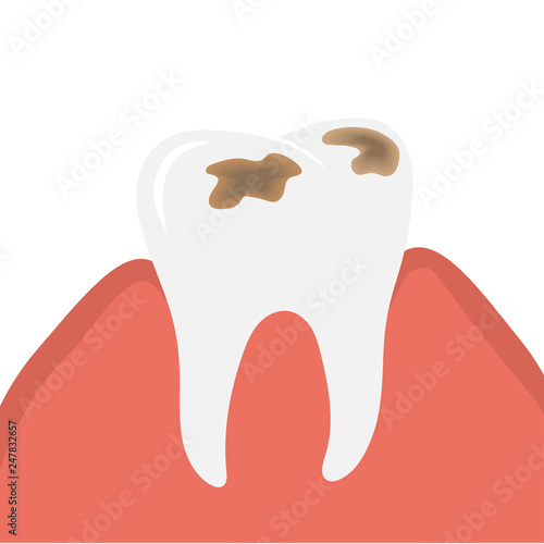 Decay and destroy tooth or dental caries