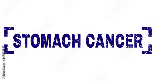 STOMACH CANCER tag seal imprint with grunge style. Text tag is placed between corners. Blue vector rubber print of STOMACH CANCER with grunge texture.