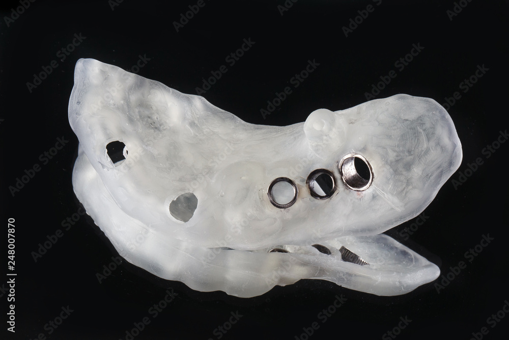 Dental template for implantation, filmed on the mirror with black background Dental template for implantation, filmed on the mirror with black background