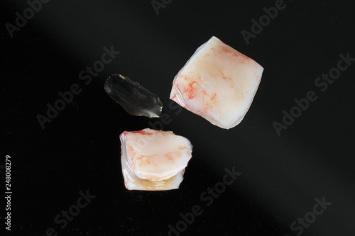 Dental fragments of soft tissue to restore the gums