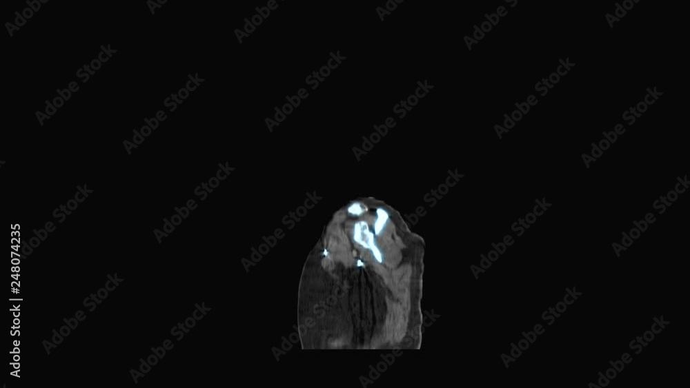 Medical CT or CAT images MRI Scanner display Medical CT or CAT images MRI Scanner display