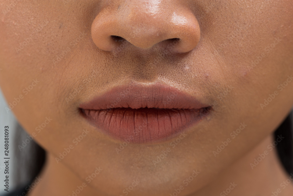 Fototapeta premium Closeup macro portrait of female matt red lip, Human woman open mouth with day beauty makeup. Girl with perfect acne wart skin and freckles with nose