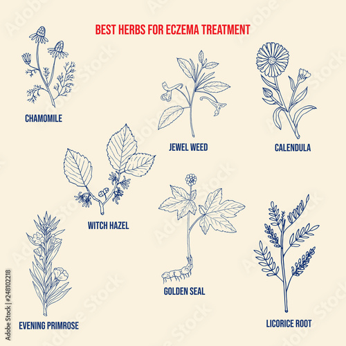 Best medicinal herbs for eczema