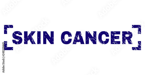 SKIN CANCER label seal watermark with grunge effect. Text label is placed between corners. Blue vector rubber print of SKIN CANCER with grunge texture.