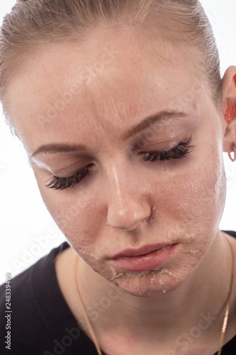 face after peeling photo