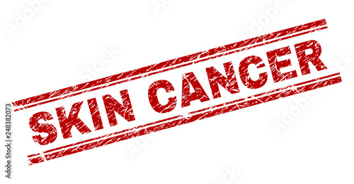 SKIN CANCER seal stamp with grunge texture. Red vector rubber print of SKIN CANCER text with retro texture. Text title is placed between double parallel lines.