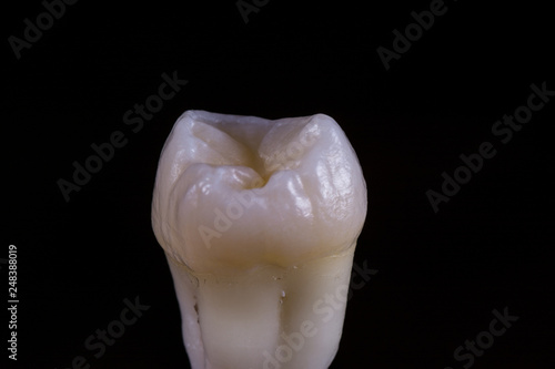 Tooth 28