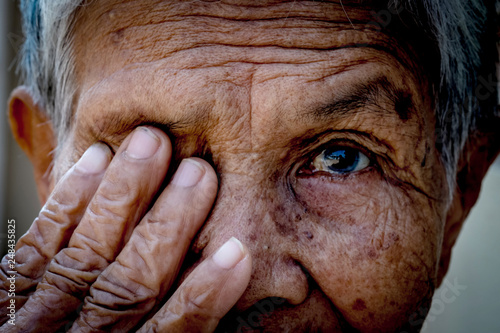 Old women cover her eye with her hand for eye testing use for medical and healthcare background photo