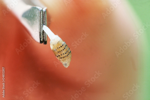 bot fly larvae between tweezers