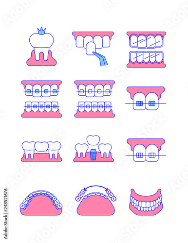 Dental clinic surgery services thin line vector icons. Dental implant, bridge, veneer, crown concepts. Orthodontic treatment such as metal, ceramic, lingual, plastic braces. Removable denture symbol