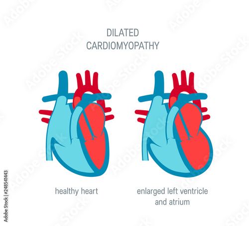 Heart disease vector concept in flat style