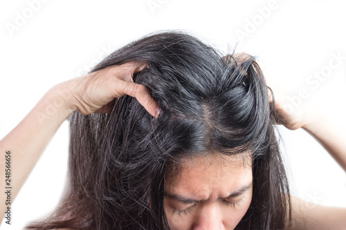 women head with dandruff Caused by the problem of dirty. Or caused by skin disease or Seborrheic Dermatitis. It has white scaly and it will cause itch.