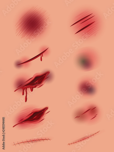 Set of different wound