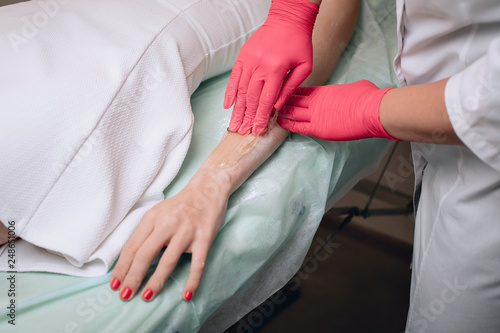 Beautician removes hair from a woman's hand. Sugaring. Hair removal with a special sugar paste has many advantages over wax depilation. Close up. © Semachkovsky 
