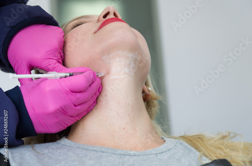 Great concept of aesthetic treatment of jowls, injection of deoxycholic acid.