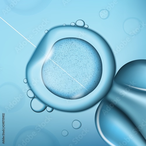 Medical operation, laser needle in cell injection