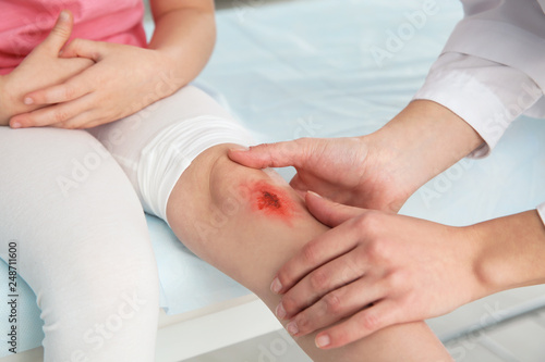 Female doctor examining little girl's injured leg in clinic, closeup. First aid