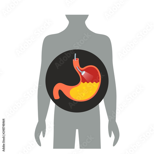 endoscope light on examination in the stomach.