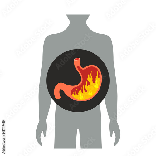 heartburn in the stomach. flat vector illustration isolated