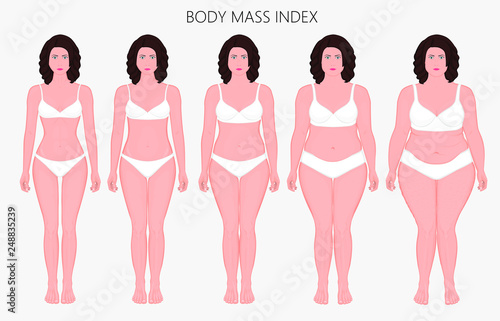 Vector illustration Human body mass Index, European woman from lack of weight to obesity Front view. For advertising of cosmetic plastic procedures, stomach shunting, diet, medical publications