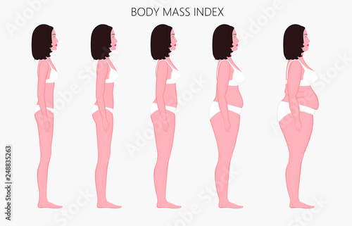Vector illustration Human body mass Index, European woman from lack of weight to obesity. Side view. For advertising of cosmetic plastic procedures, stomach shunting, diet, medical publications