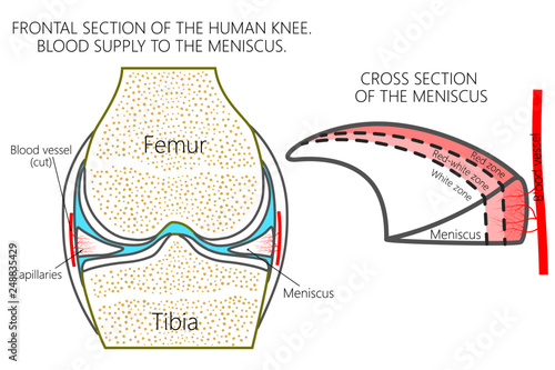 Vector illustration. Frontal section of a healthy human knee, blood supply of the meniscus (red, red-white and white zones). For advertising, medical publications photo