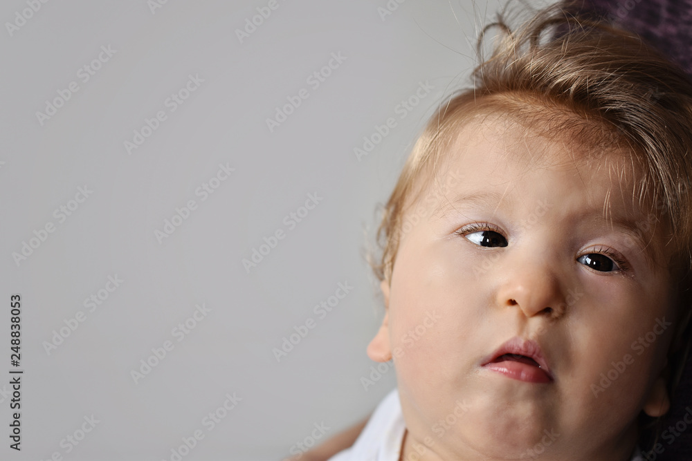 cute baby one year old happy disabled child portrait close-up - image cute baby one year old happy disabled child portrait close-up - image