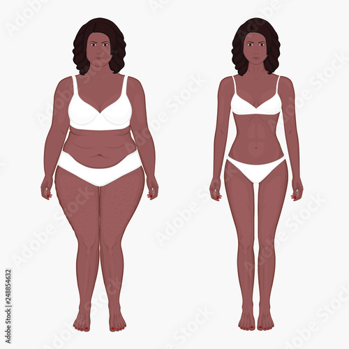 Vector illustration body weight loss in African American woman from obesity to normal. Front view. For advertising of cosmetic plastic procedures, stomach shunting, diet; medical publications