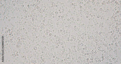 Budding yeast cell under the microscope.
