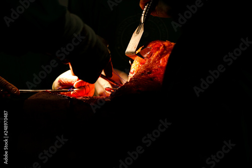 Foto operation of an ear and abdomen in a surgery room of the university hospital, performing reconstruction in plastic surgery with the appropriate instruments and under general anesthesia