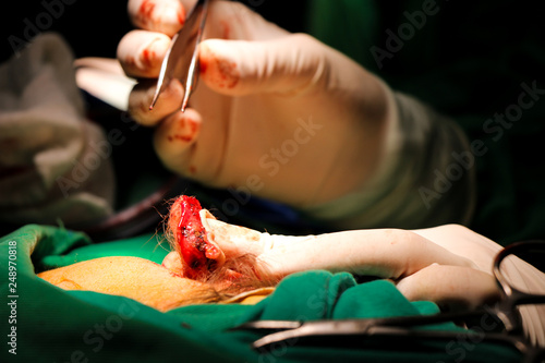  operation of an ear and abdomen in a surgery room of the university hospital, performing reconstruction in plastic surgery with the appropriate instruments and under general anesthesia.