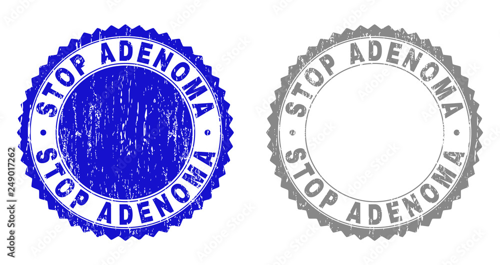 Grunge STOP ADENOMA stamp seals isolated on a white background. Rosette seals with grunge texture in blue and grey colors. Vector rubber stamp imprint of STOP ADENOMA tag inside round rosette.