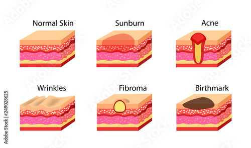 Skin problems icons set. Vector stock illustration.