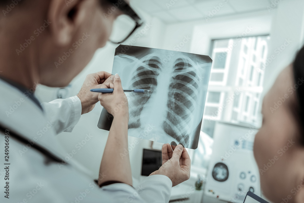Naklejka premium Doctors having hard times with photo of rib cage bones