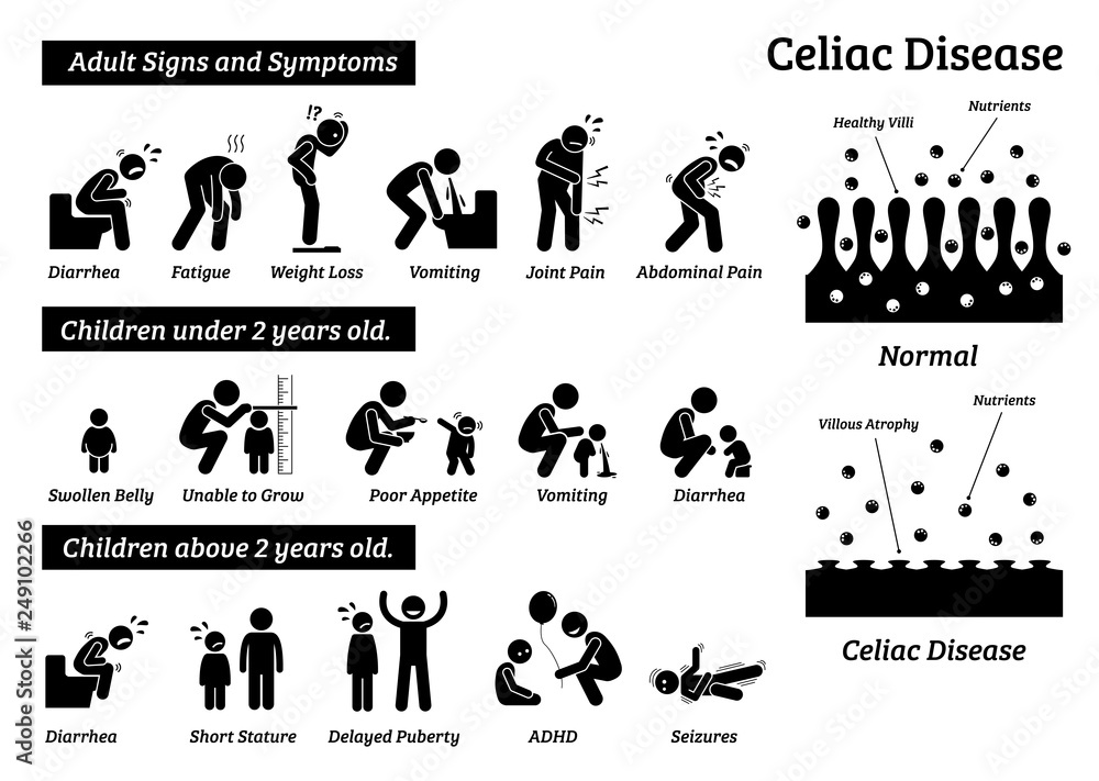 celiac-disease-signs-and-symptoms-illustrations-depict-celiac-disease