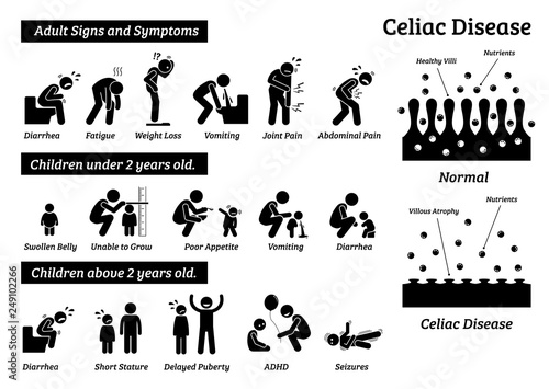Celiac disease signs and symptoms. Illustrations depict celiac disease problems in adult and children.