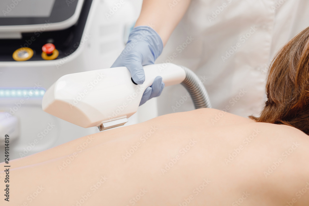 Obraz premium Laser hair removal on male back. Concept of self-confidence, beauty and health. Close up