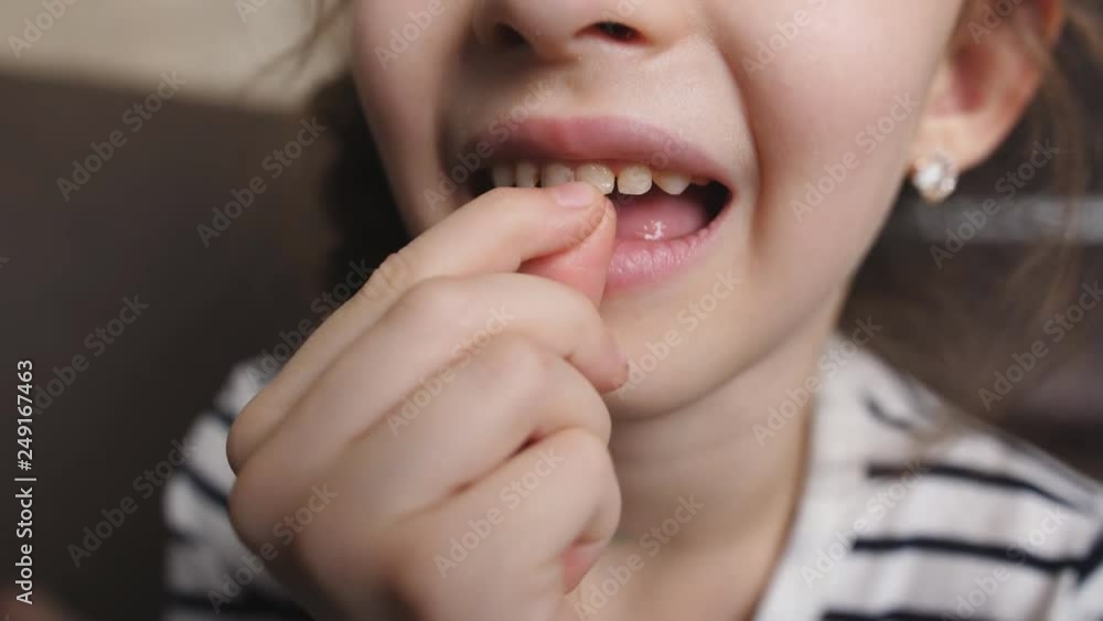 The little girl's hand loosens a tooth in the mouth. The little girl's hand loosens a tooth in the mouth.