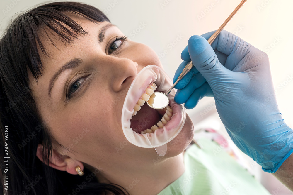 Macro of patient's teeth with dentist's mirror Macro of patient's teeth with dentist's mirror