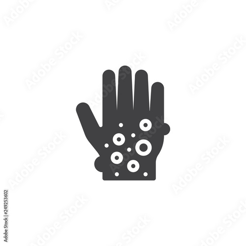 Eczema hand skin vector icon. filled flat sign for mobile concept and web design. Rash hand, allergic reaction simple glyph icon. Symbol, logo illustration. Pixel perfect vector graphics