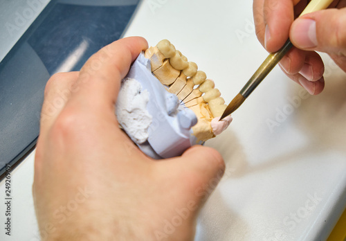 Technician dental is working with complete lower and upper metal ceramic prosthesis dental. Dental technician works by brush with jaw model