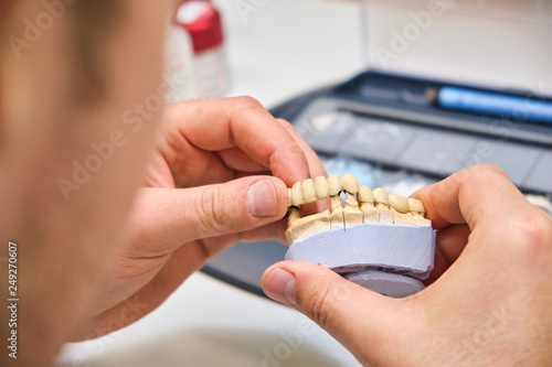 Technician dental is working with complete lower and upper metal ceramic prosthesis dental. Dental technician works by brush with jaw model
