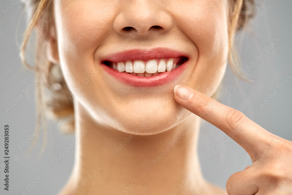 oral care, dental hygiene and people concept - close up of finger pointing to woman face with healthy white teeth over gray background oral care, dental hygiene and people concept - close up of finger pointing to woman face with healthy white teeth over gray background
