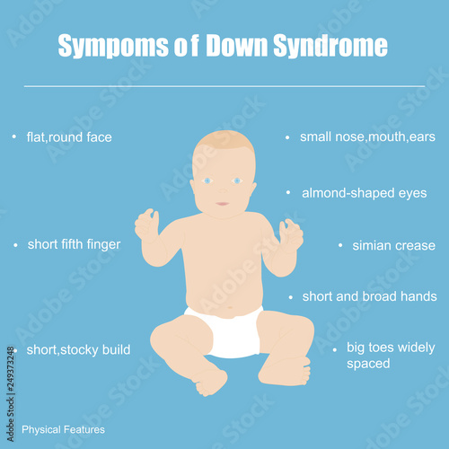 Symptoms Of Down Syndrome Stock Vector Adobe Stock Symptoms Of Down Syndrome Stock Vector Adobe Stock
